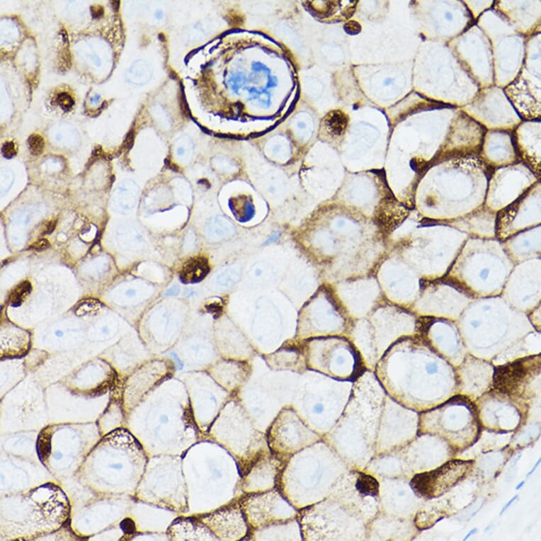 Immunohistochemistry - Anti-MUC1 Antibody [ARC0352] (A309097) - Antibodies.com