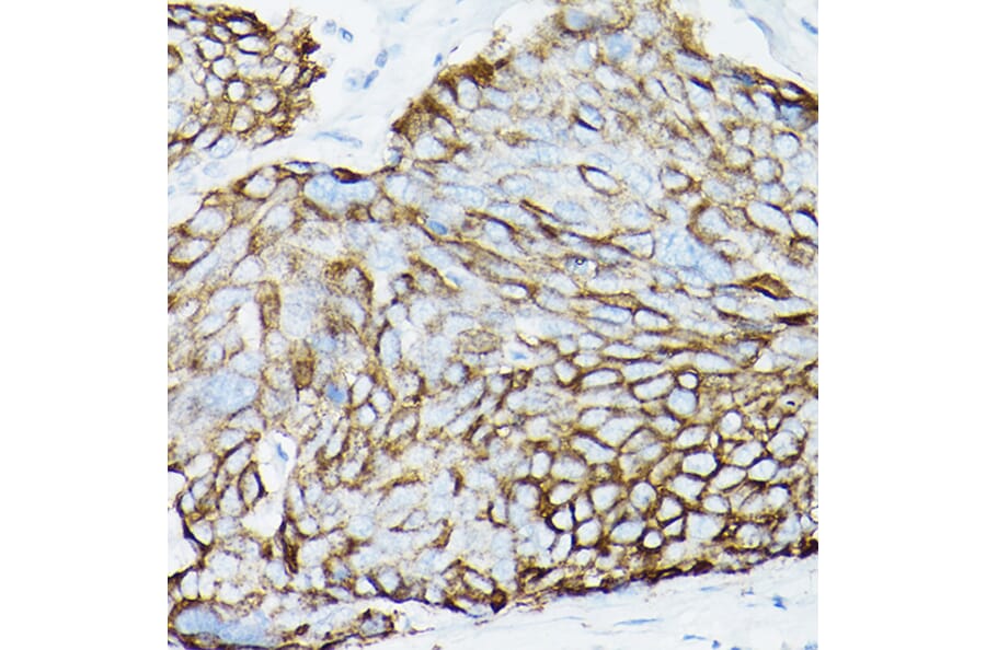 Immunohistochemistry - Anti-MUC1 Antibody [ARC0352] (A309097) - Antibodies.com