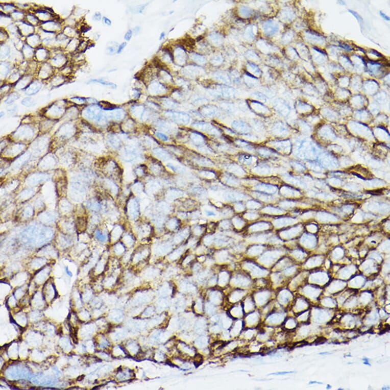 Immunohistochemistry - Anti-MUC1 Antibody [ARC0352] (A309097) - Antibodies.com