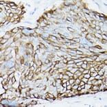 Immunohistochemistry - Anti-MUC1 Antibody [ARC0352] (A309097) - Antibodies.com