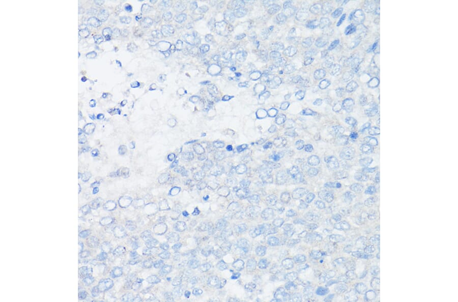 Immunohistochemistry - Anti-MUC1 Antibody [ARC0352] (A309097) - Antibodies.com