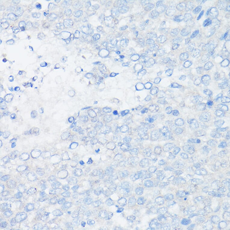 Immunohistochemistry - Anti-MUC1 Antibody [ARC0352] (A309097) - Antibodies.com