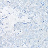 Immunohistochemistry - Anti-MUC1 Antibody [ARC0352] (A309097) - Antibodies.com