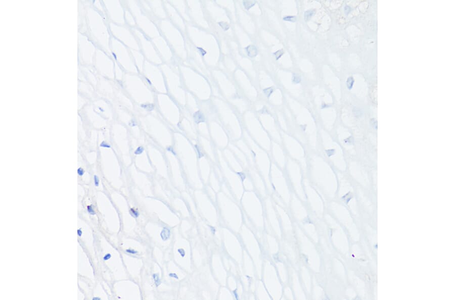 Immunohistochemistry - Anti-MUC1 Antibody [ARC0352] (A309097) - Antibodies.com