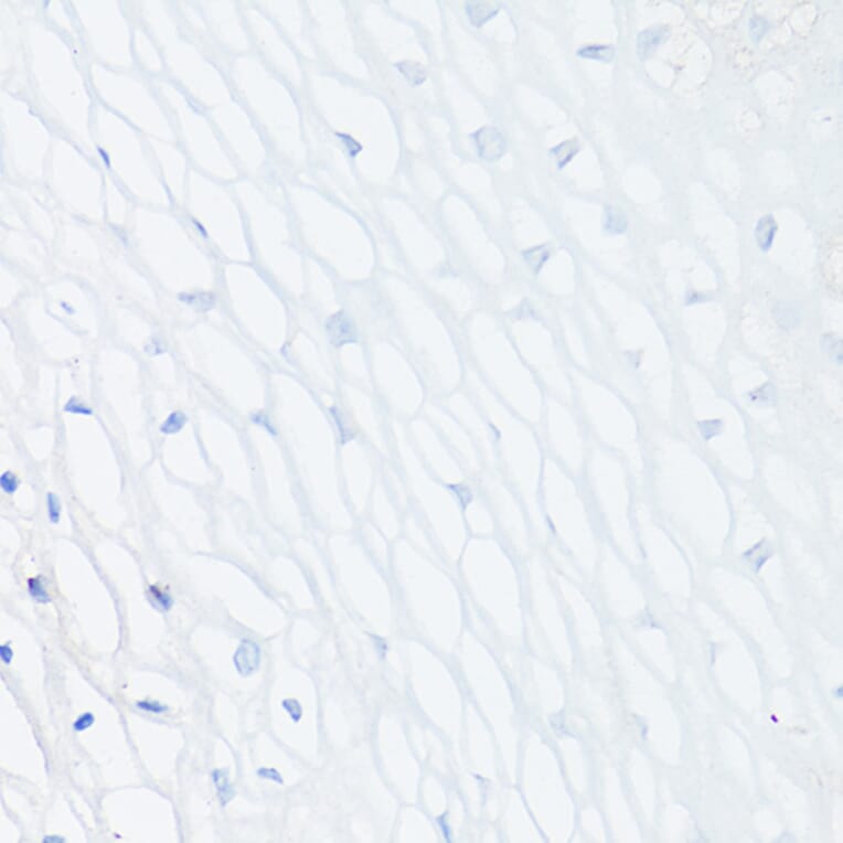 Immunohistochemistry - Anti-MUC1 Antibody [ARC0352] (A309097) - Antibodies.com