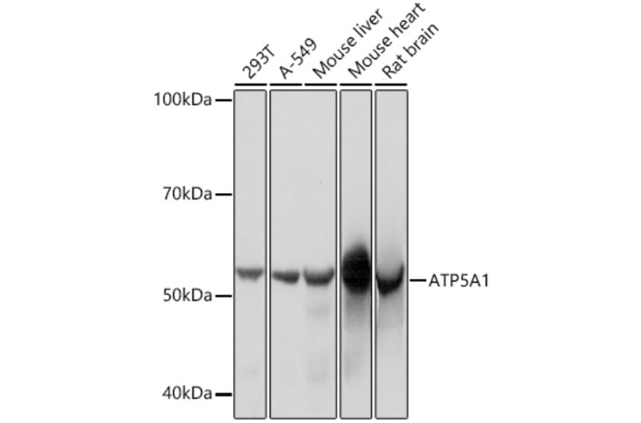 Western Blot - Anti-ATP5A Antibody [ARC0549] (A309098) - Antibodies.com