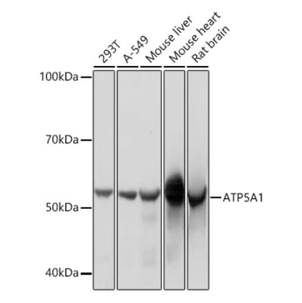 Western Blot - Anti-ATP5A Antibody [ARC0549] (A309098) - Antibodies.com
