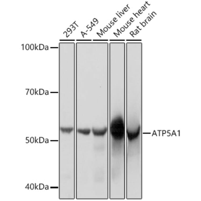 Western Blot - Anti-ATP5A Antibody [ARC0549] (A309098) - Antibodies.com