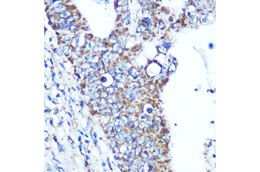 Immunohistochemistry - Anti-ATP5A Antibody [ARC0549] (A309098) - Antibodies.com
