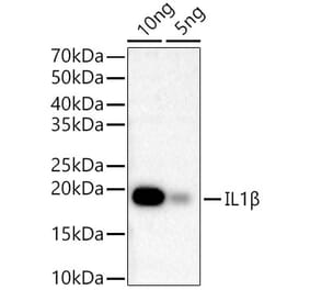 Western Blot - Anti-IL-1 beta Antibody (A309100) - Antibodies.com