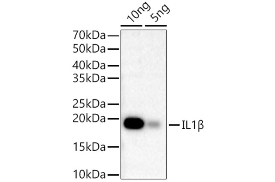 Western Blot - Anti-IL-1 beta Antibody [ARC56180] (A309100) - Antibodies.com