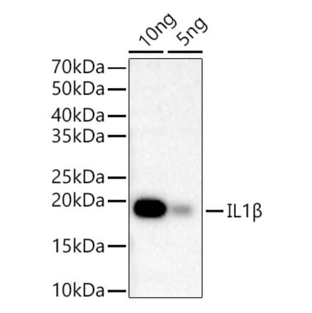 Western Blot - Anti-IL-1 beta Antibody [ARC56180] (A309100) - Antibodies.com