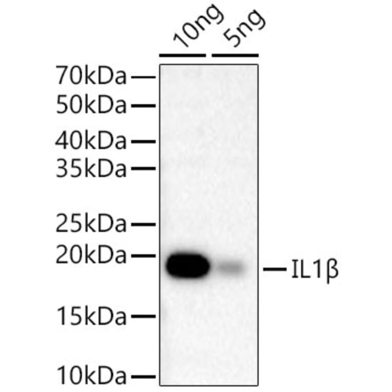 Western Blot - Anti-IL-1 beta Antibody [ARC56180] (A309100) - Antibodies.com