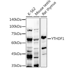 Western Blot - Anti-YTHDF1 Antibody (A309101) - Antibodies.com