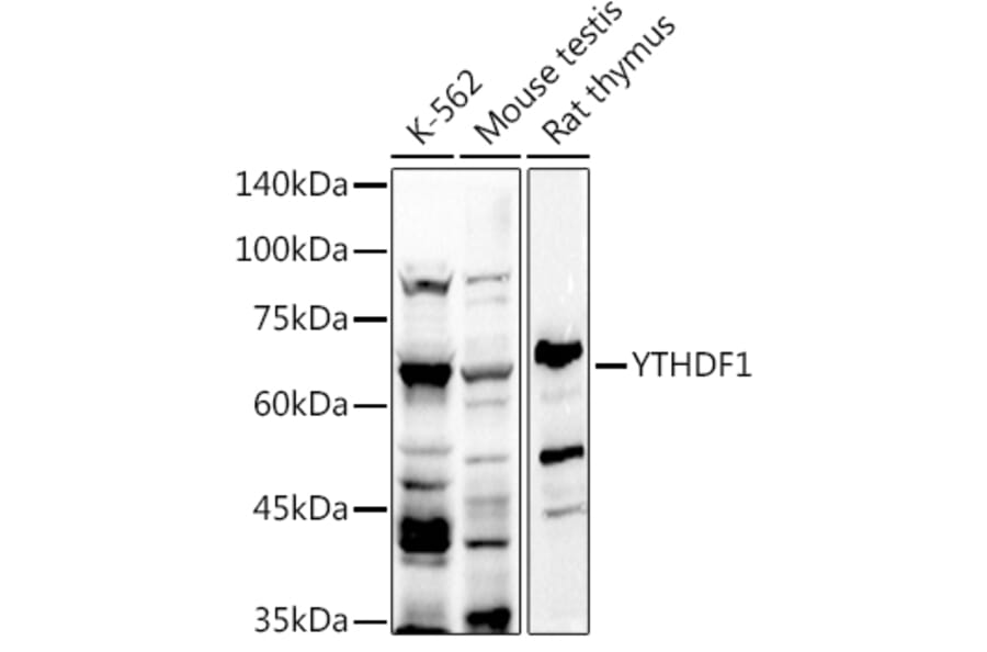 Western Blot - Anti-YTHDF1 Antibody (A309101) - Antibodies.com