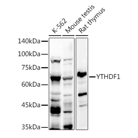 Western Blot - Anti-YTHDF1 Antibody (A309101) - Antibodies.com