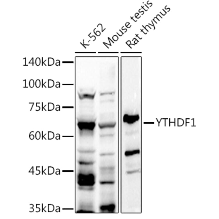 Western Blot - Anti-YTHDF1 Antibody (A309101) - Antibodies.com