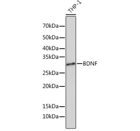 Western Blot - Anti-BDNF Antibody [ARC0303] (A309102) - Antibodies.com