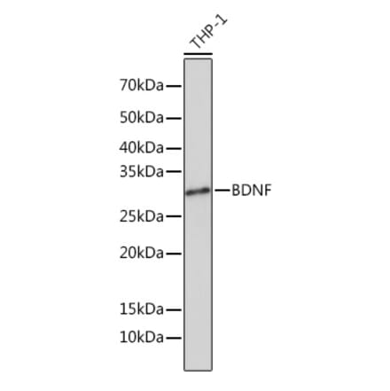 Western Blot - Anti-BDNF Antibody [ARC0303] (A309102) - Antibodies.com