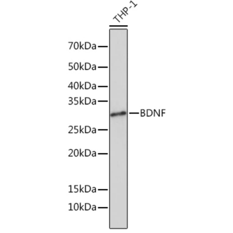 Western Blot - Anti-BDNF Antibody [ARC0303] (A309102) - Antibodies.com