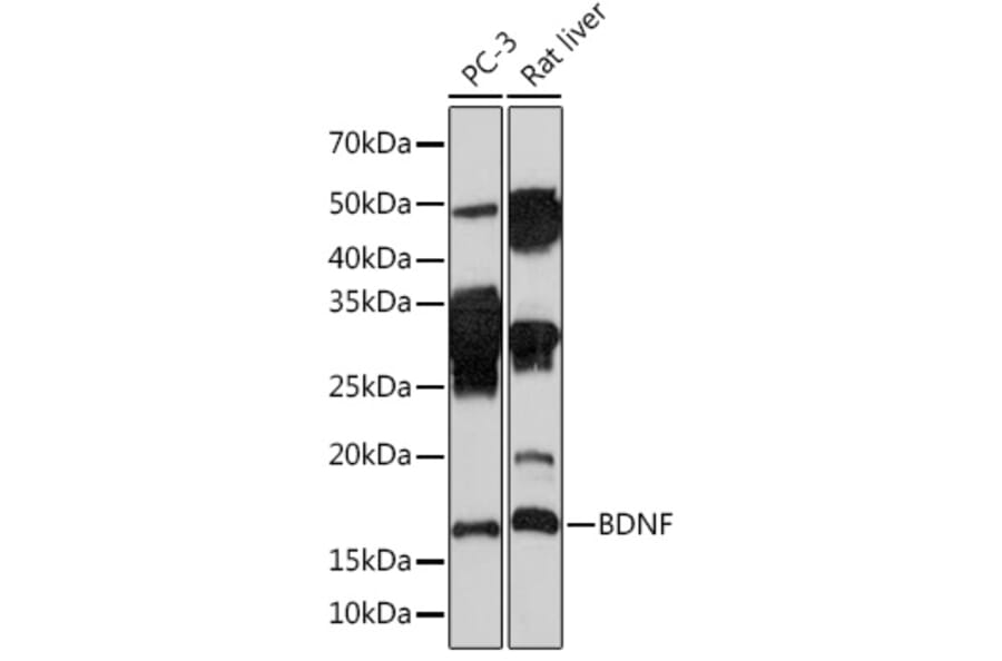Western Blot - Anti-BDNF Antibody [ARC0303] (A309102) - Antibodies.com