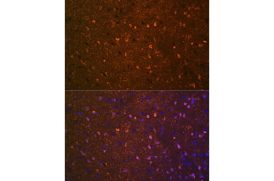 Immunofluorescence - Anti-BDNF Antibody [ARC0303] (A309102) - Antibodies.com