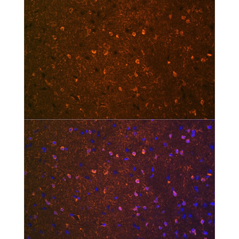 Immunofluorescence - Anti-BDNF Antibody [ARC0303] (A309102) - Antibodies.com