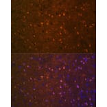 Immunofluorescence - Anti-BDNF Antibody [ARC0303] (A309102) - Antibodies.com