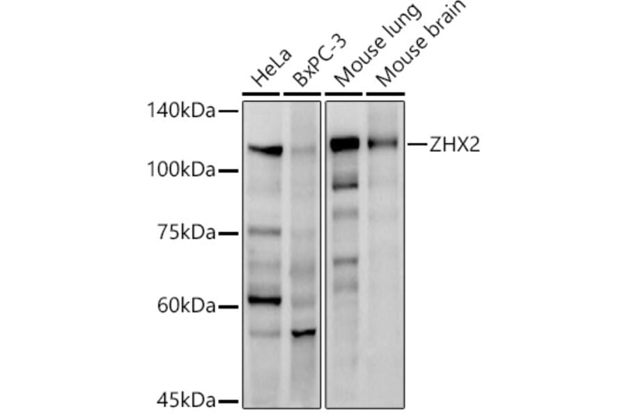 Western Blot - Anti-ZHX2 Antibody [ARC2826] (A309103) - Antibodies.com