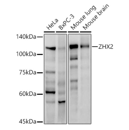Western Blot - Anti-ZHX2 Antibody [ARC2826] (A309103) - Antibodies.com
