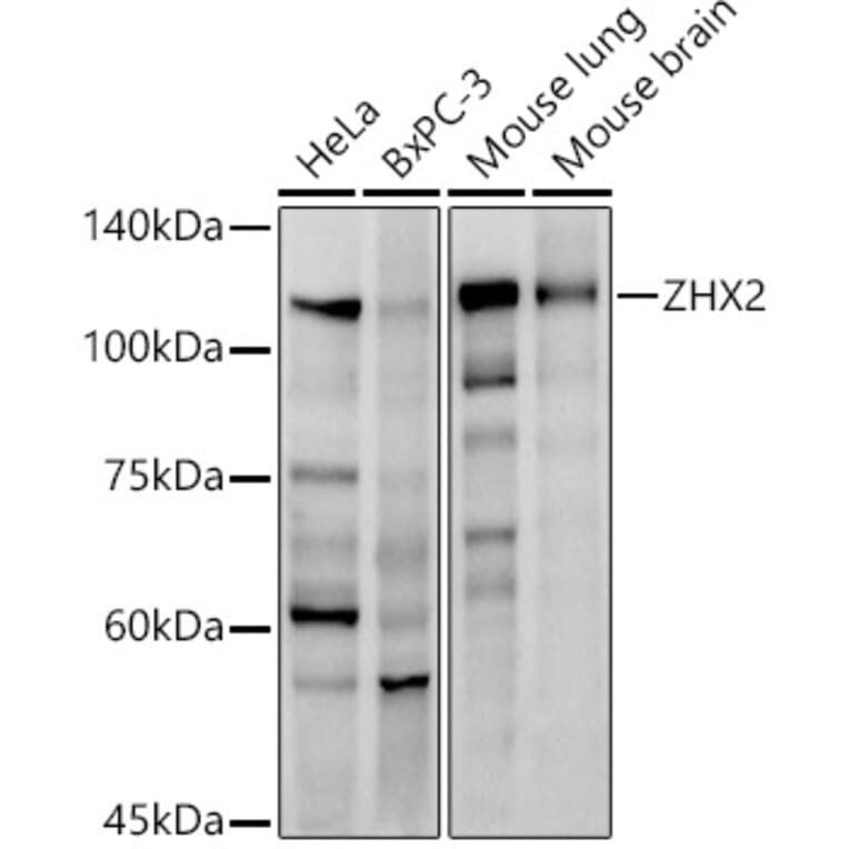 Western Blot - Anti-ZHX2 Antibody [ARC2826] (A309103) - Antibodies.com