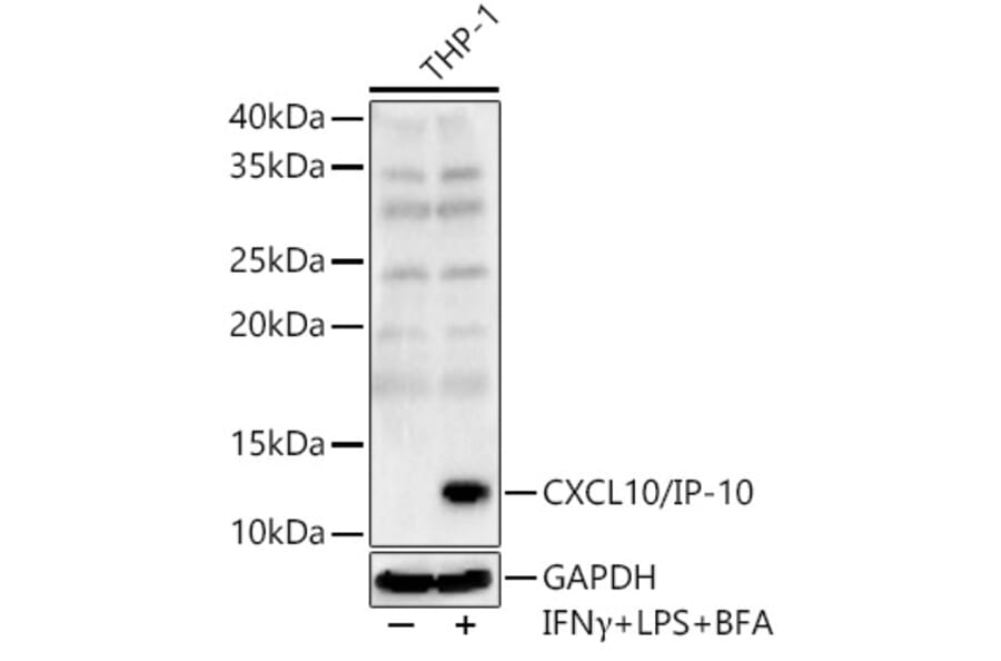 Western Blot - Anti-IP10 Antibody (A309104) - Antibodies.com