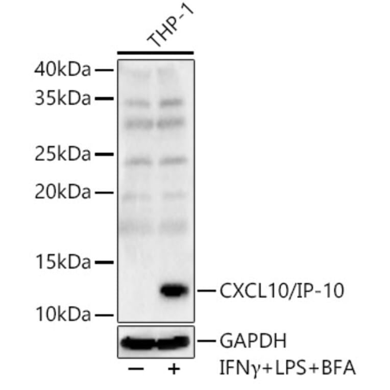 Western Blot - Anti-IP10 Antibody (A309104) - Antibodies.com