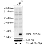 Western Blot - Anti-IP10 Antibody (A309104) - Antibodies.com