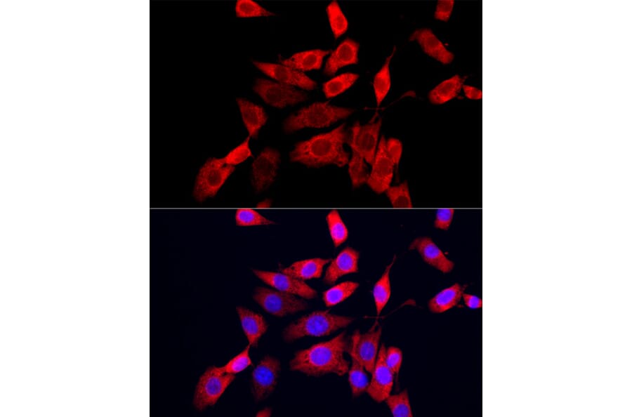 Immunofluorescence - Anti-IP10 Antibody (A309104) - Antibodies.com