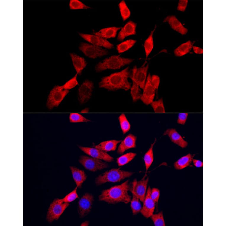 Immunofluorescence - Anti-IP10 Antibody (A309104) - Antibodies.com