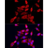 Immunofluorescence - Anti-IP10 Antibody (A309104) - Antibodies.com