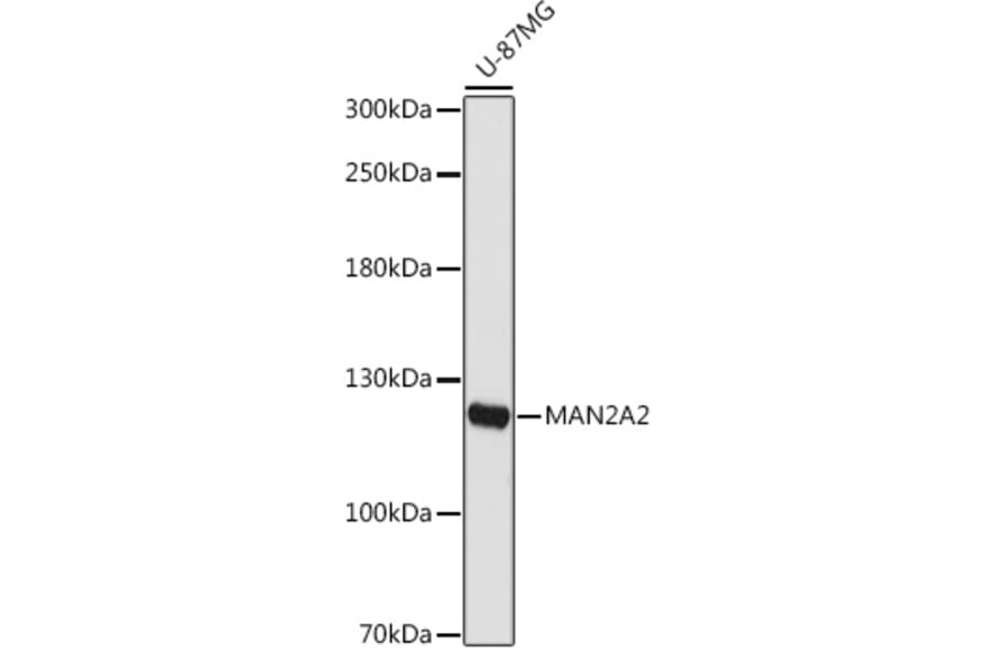 Western Blot - Anti-MAN2A2 Antibody (A309105) - Antibodies.com