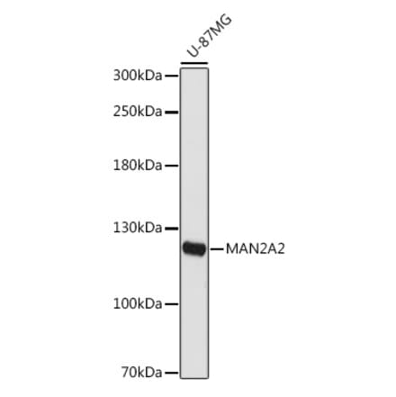 Western Blot - Anti-MAN2A2 Antibody (A309105) - Antibodies.com