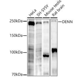Western Blot - Anti-DENN Antibody [ARC2860] (A309107) - Antibodies.com