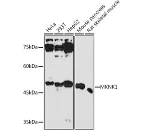 Western Blot - Anti-MNK1 Antibody (A309108) - Antibodies.com