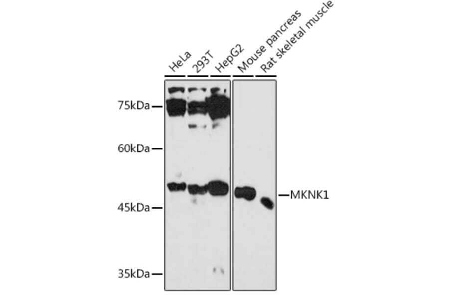 Western Blot - Anti-MNK1 Antibody (A309108) - Antibodies.com