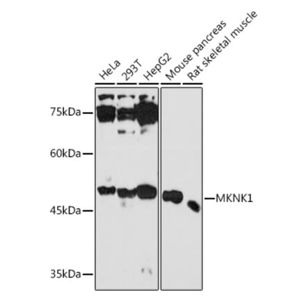 Western Blot - Anti-MNK1 Antibody (A309108) - Antibodies.com