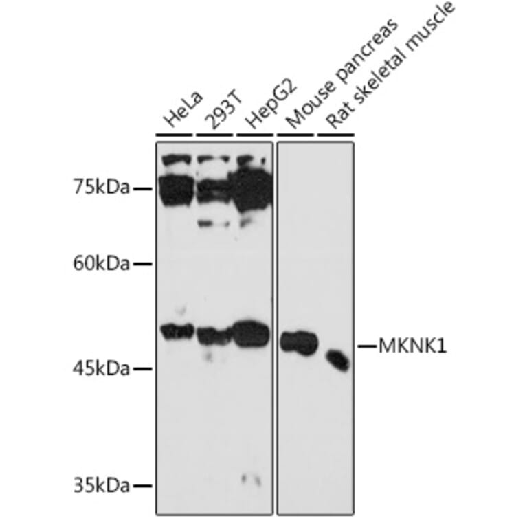 Western Blot - Anti-MNK1 Antibody (A309108) - Antibodies.com