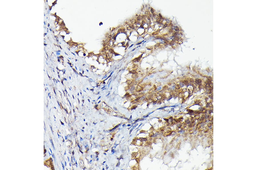 Immunohistochemistry - Anti-MNK1 Antibody (A309108) - Antibodies.com