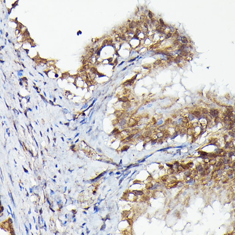 Immunohistochemistry - Anti-MNK1 Antibody (A309108) - Antibodies.com