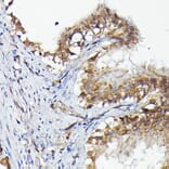 Immunohistochemistry - Anti-MNK1 Antibody (A309108) - Antibodies.com