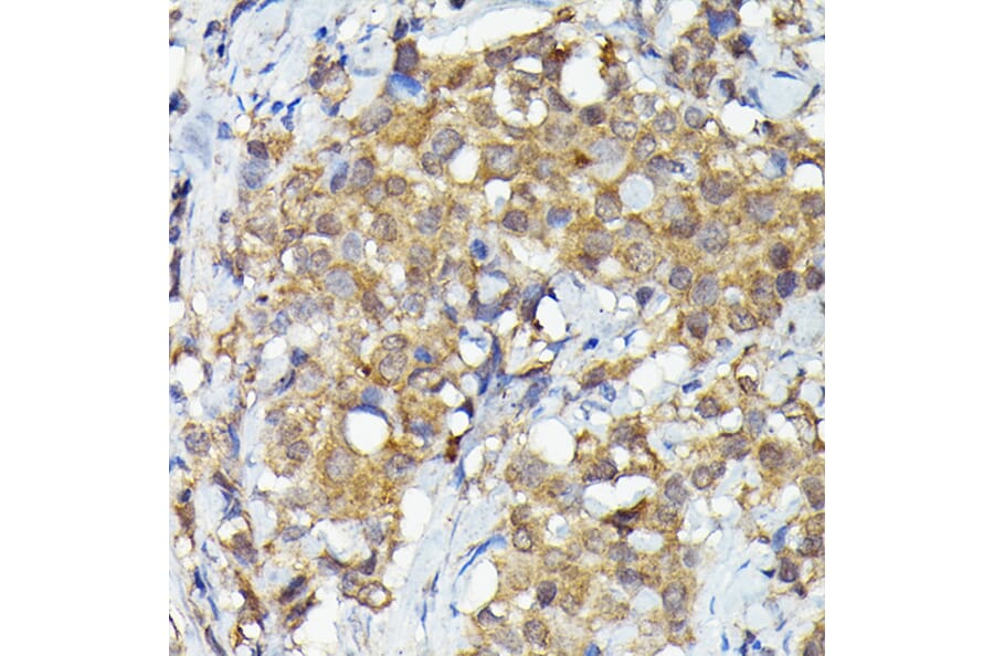 Immunohistochemistry - Anti-MNK1 Antibody (A309108) - Antibodies.com