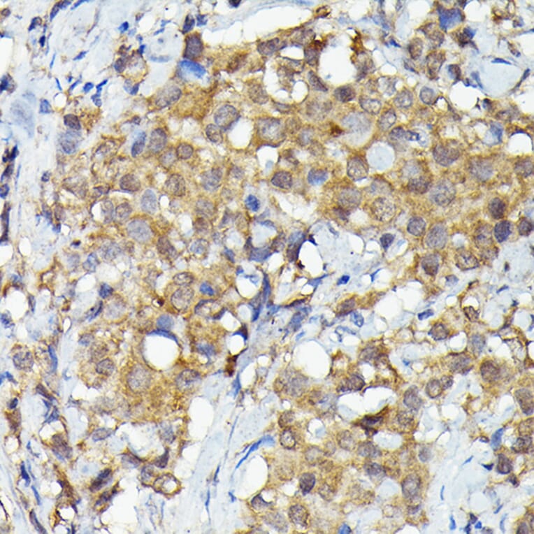 Immunohistochemistry - Anti-MNK1 Antibody (A309108) - Antibodies.com