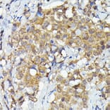 Immunohistochemistry - Anti-MNK1 Antibody (A309108) - Antibodies.com